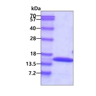 SDS-PAGE: Recombinant Human TTC11 His Protein [NBP1-44386]